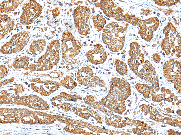 NDUFB10 Antibody