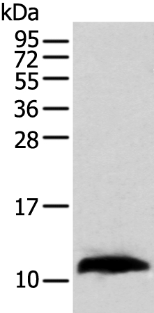 TBCA Antibody