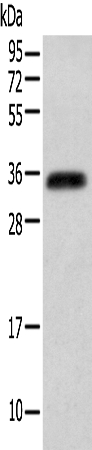 ITLN2 Antibody