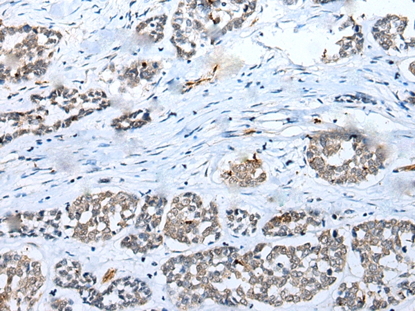 SYCE3 Antibody