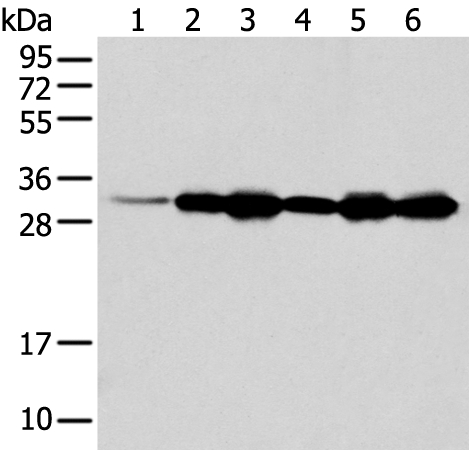 NUDT22 Antibody