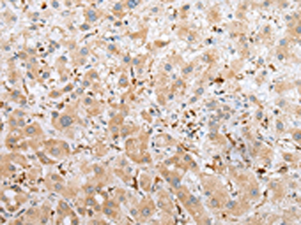 NPL Antibody