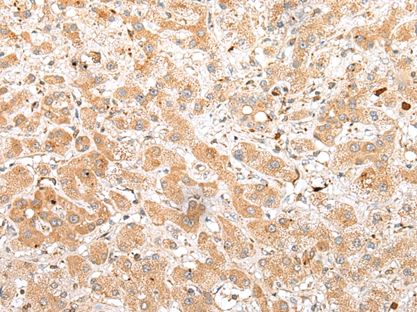 FKBP6 Antibody