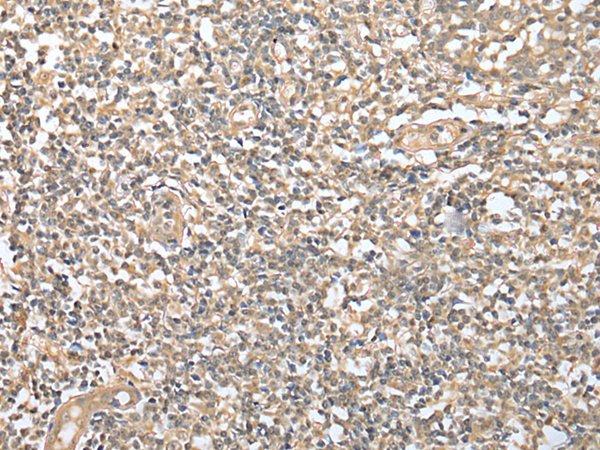 DPYD Antibody