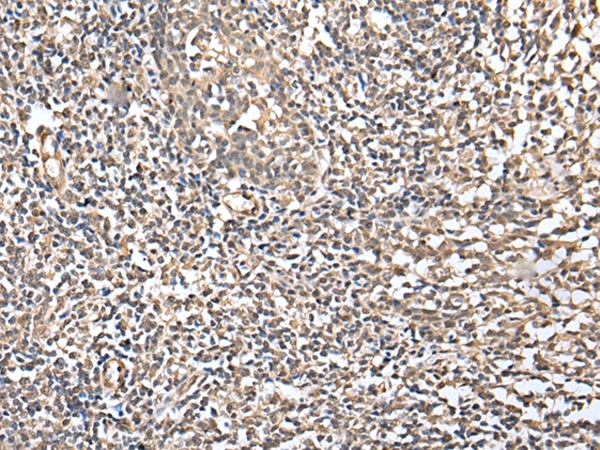 CSRP3 Antibody