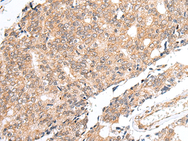 PRELID1 Antibody