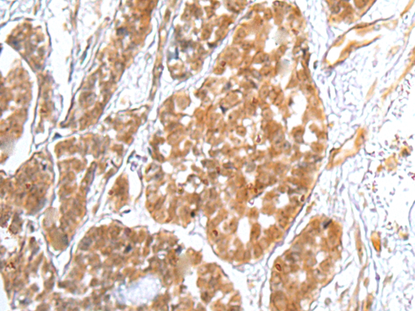 TRAPPC4 Antibody