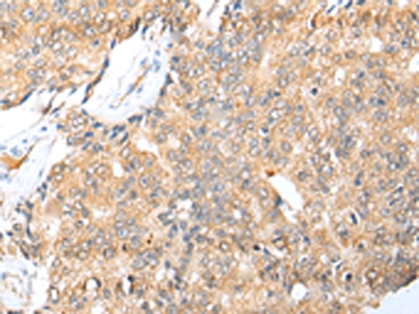 LYPLA1 Antibody