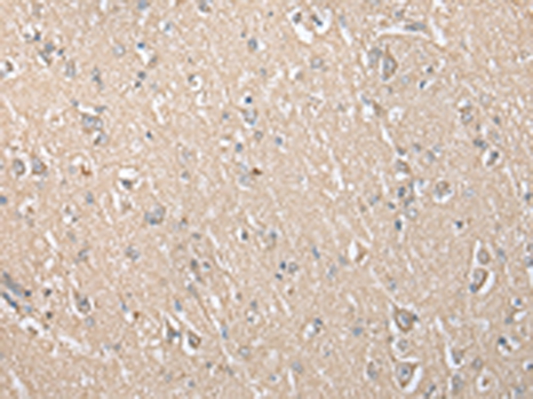 ECI1 Antibody