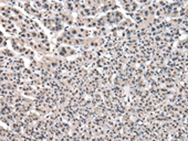 PTBP1 Antibody