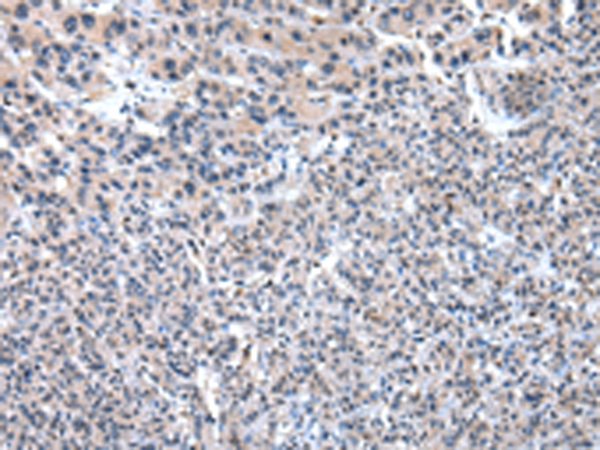 PKLR Antibody