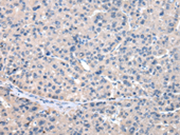 GCLM Antibody