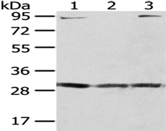 GCLM Antibody