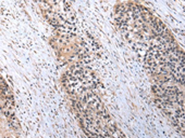 C1QB Antibody