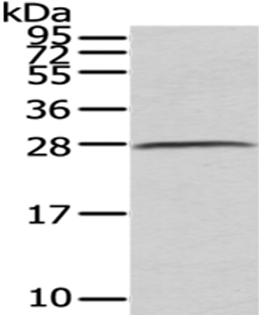 C1QB Antibody