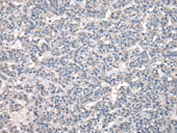 NPC2 Antibody