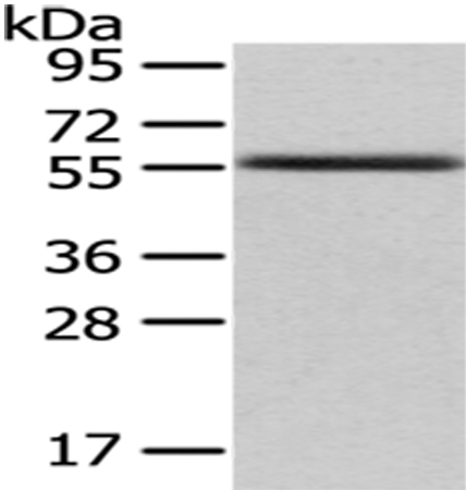 UMPS Antibody