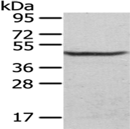 CS Antibody