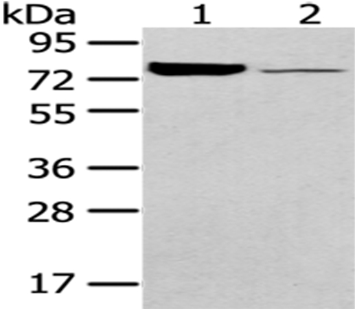 PGM1 Antibody