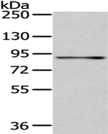 SSRP1 Antibody