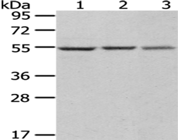 DARS Antibody