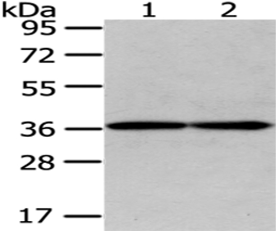 GALE Antibody