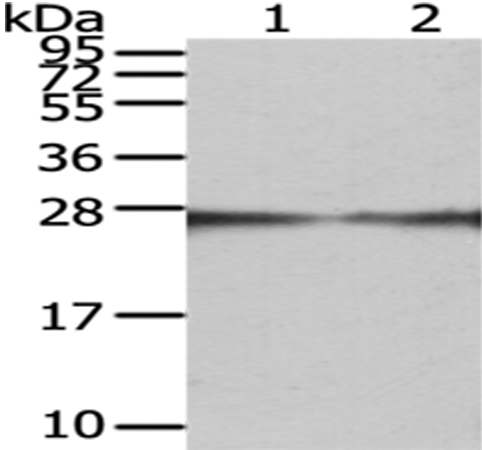 GAMT Antibody