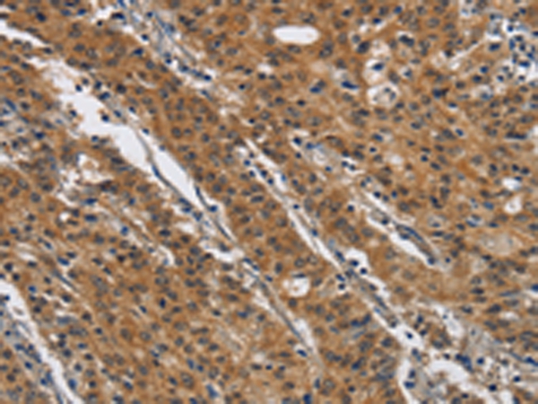 DTNBP1 Antibody