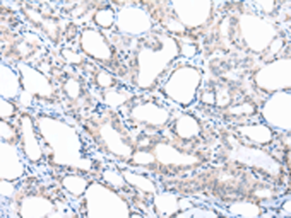 PPBP Antibody