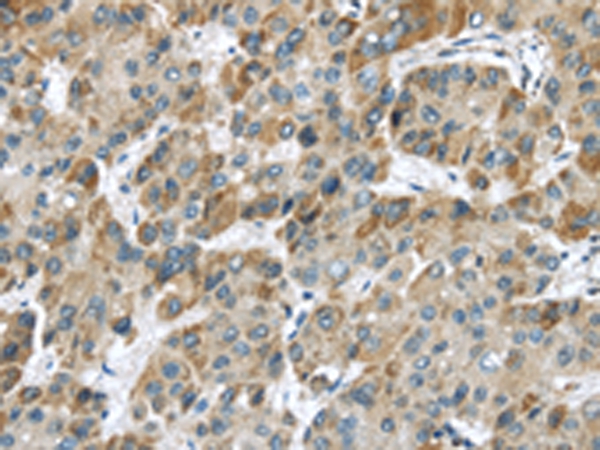 CHRNA1 Antibody