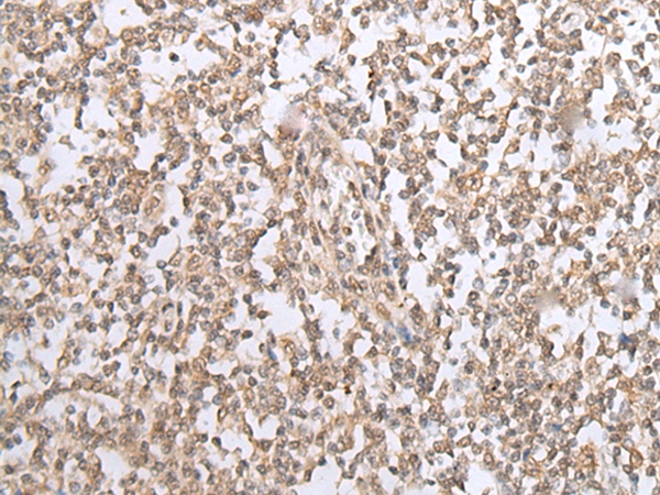 CARM1/PRMT4 Antibody