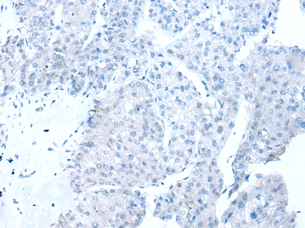 RBFOX1 Antibody