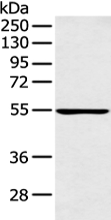 PFKFB4 Antibody