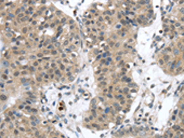 SENP6 Antibody