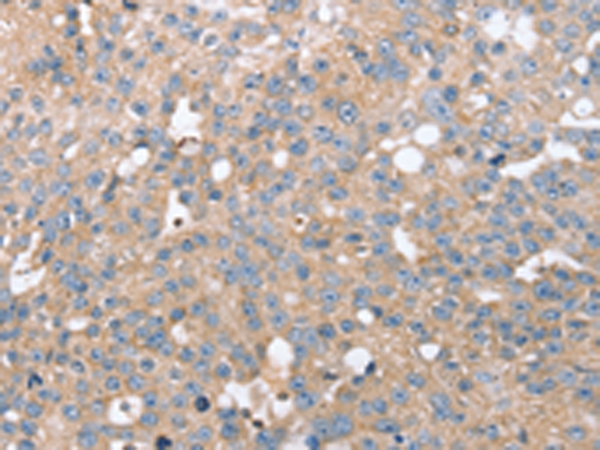 STK36 Antibody