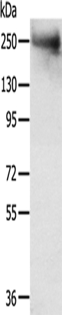 TACC2 Antibody