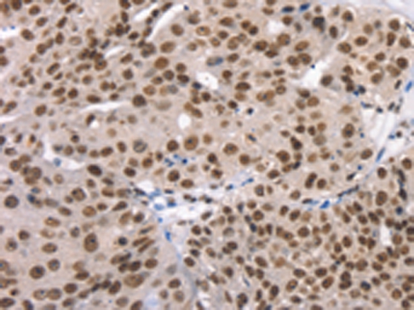 TAF15 Antibody