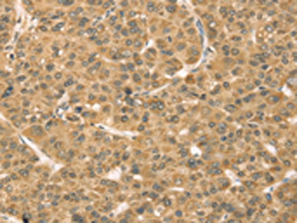 TMPRSS3 Antibody