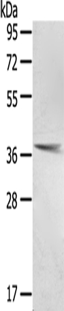 PTX3 Antibody