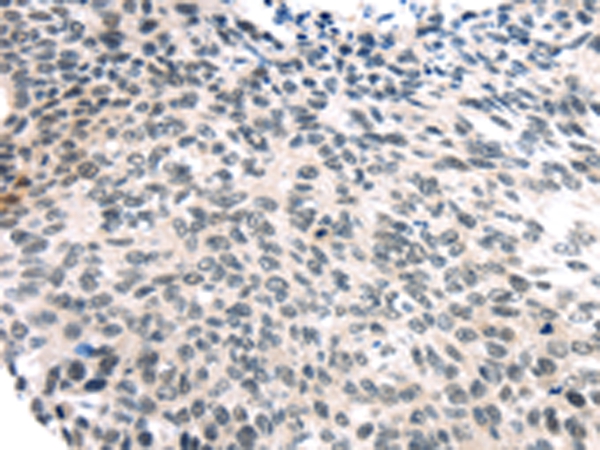 USP7 Antibody