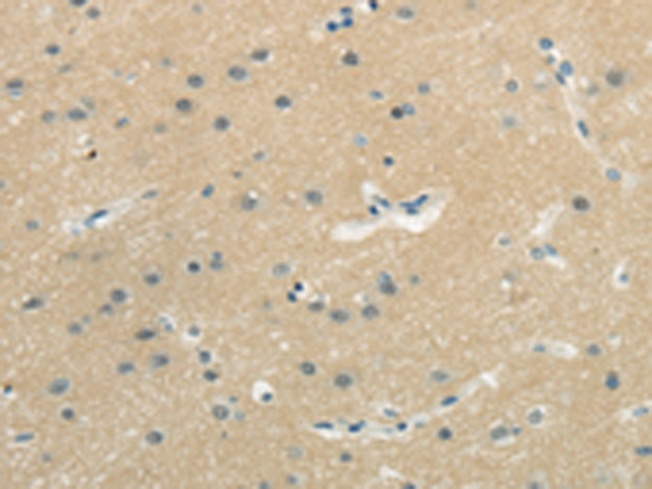 WASF3 Antibody