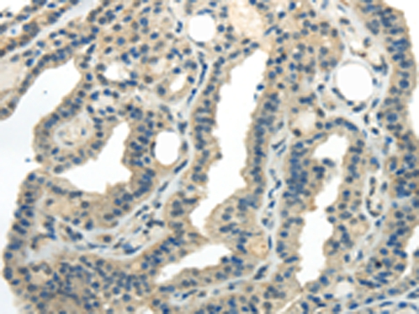 CD70  Antibody