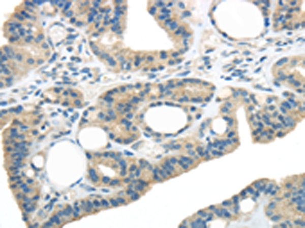 WNK3  Antibody