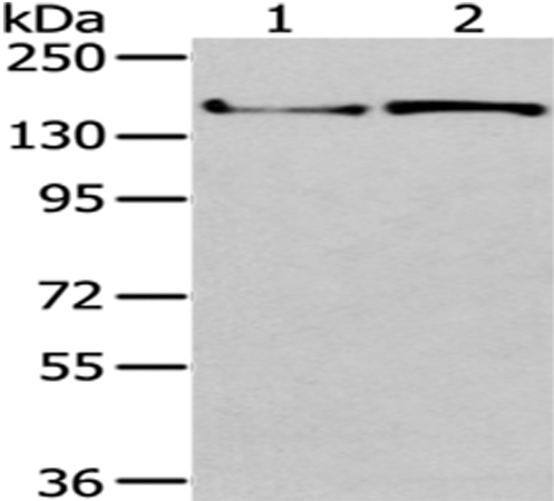 WNK3  Antibody