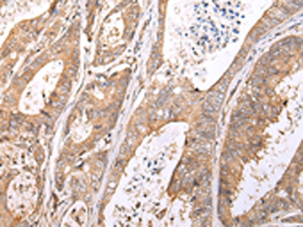 XKR7 Antibody