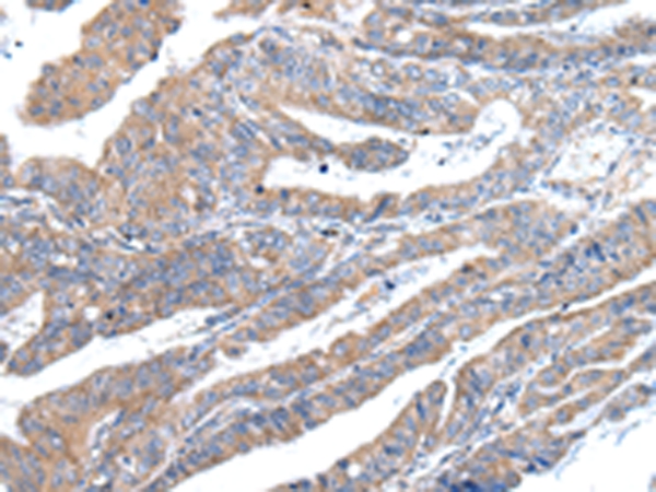 ZFAND2A Antibody