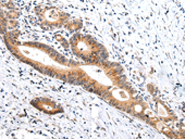 ZNF281 Antibody