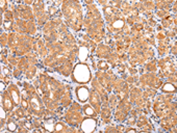 ZNF420 Antibody