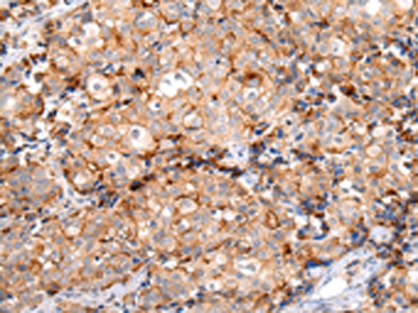 MUC1(CT) Antibody