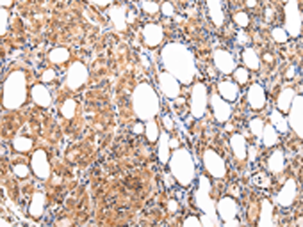 ATF1 Antibody